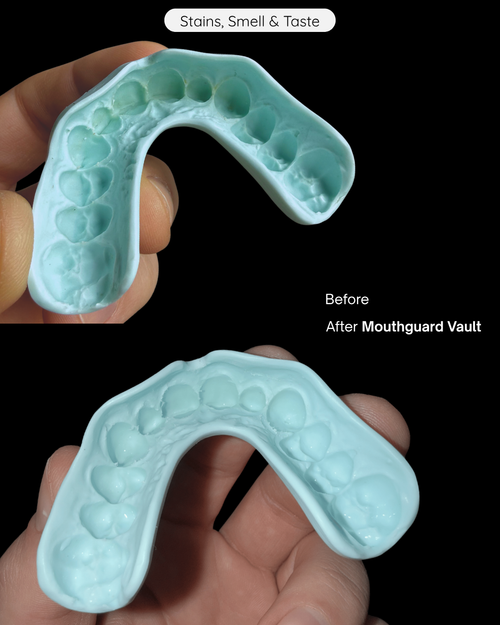The Mouthguard Vault