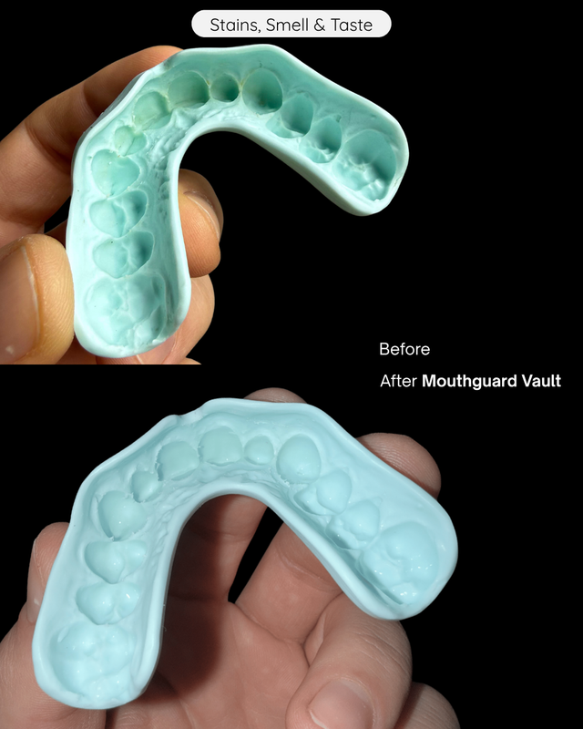The Mouthguard Vault